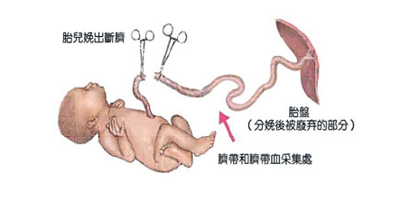 脐带血保存必须了解的事