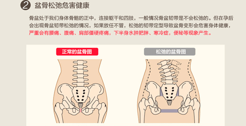 盆骨矫正带什么时候用盆骨矫正带的使用方法