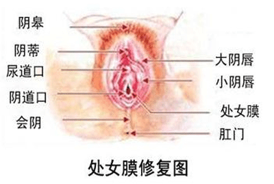 处女膜修复手术的条件