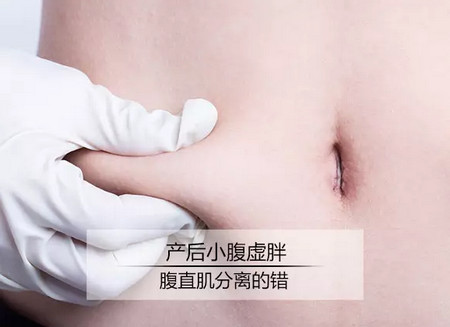 产后小肚腩怎么减，小腹虚胖可能是腹直肌分离