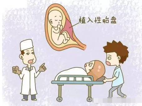 胎盘植入的原因