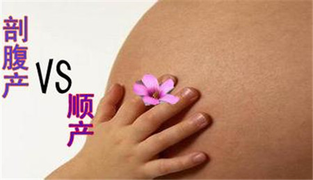 顺产vs剖腹产，听谁的？
