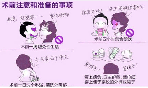 引产手术注意事项