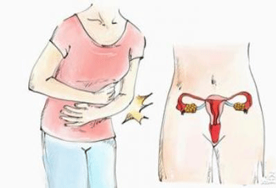 子宫息肉是如何产生的