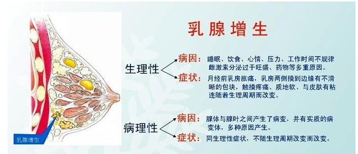 乳腺增生的相关症状和原因