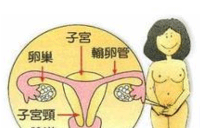 功能性子宫出血的预防