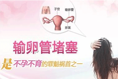 五种方法准确诊断输卵管粘连