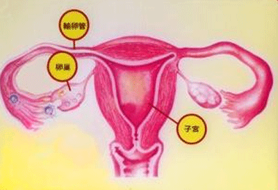 附件囊肿怎么治疗