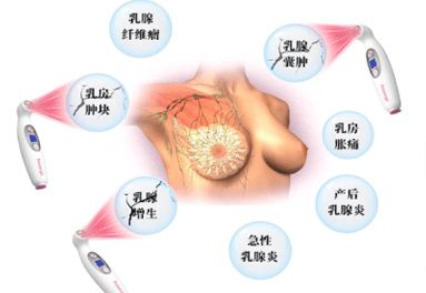 哺乳期发烧乳腺炎怎么办
