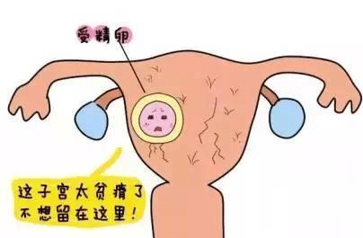 子宫炎症怎么引起的