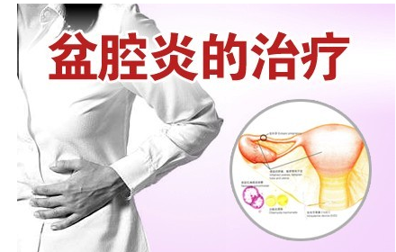 盆腔炎的治疗方法