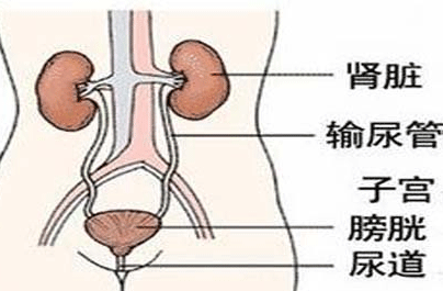 非淋性尿道炎病因