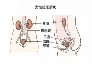 女性尿路感染的原因