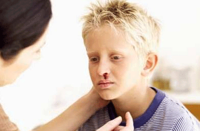 孩子流鼻血怎么回事