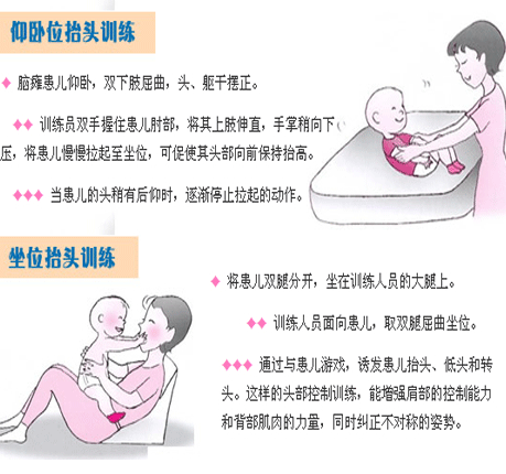小儿脑瘫康复训练