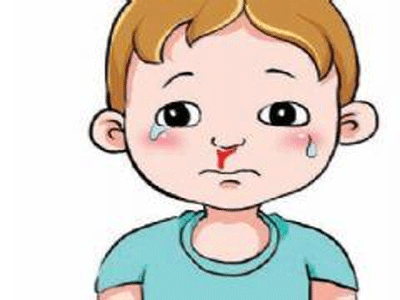 小孩鼻子出血怎么回事