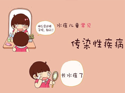 水痘的症状