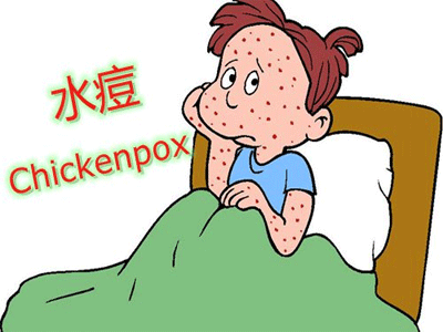 水痘的症状