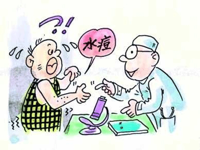水痘的治疗方法