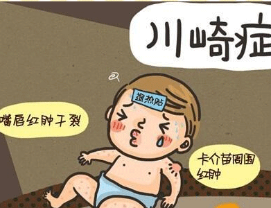 川崎病的症状