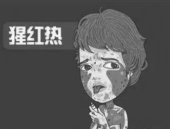 小儿猩红热早期表现