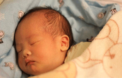 新生儿母乳性黄疸的预防