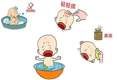 囟门闭合时间