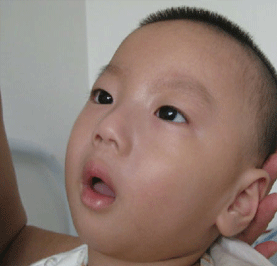 小儿脑瘫的危害