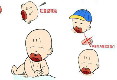 囟门闭合异常情况
