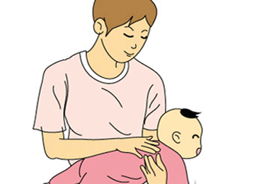 婴儿呛奶急救措施