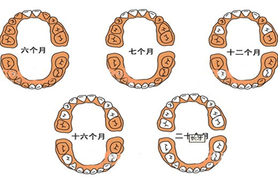 护理乳牙注意事项