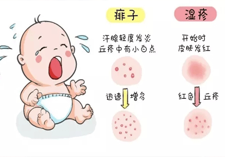 初生婴儿湿疹怎么预防