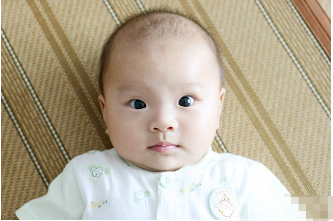 怎么辨别婴儿斗鸡眼