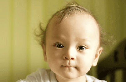 幼儿头发稀少的原因