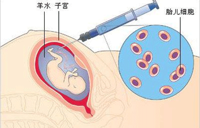 羊水亲子鉴定怎么做注意事项有哪些